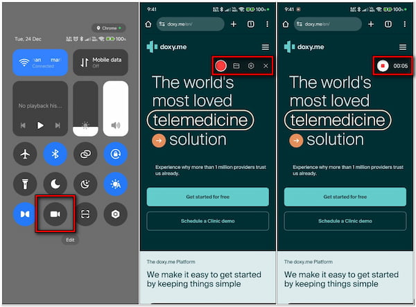 Record Doxy On Smartphone